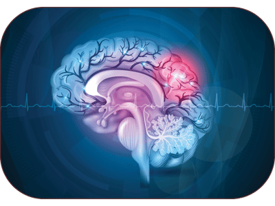 Brain Disorders Ayurvedic Treatment in Amritsar