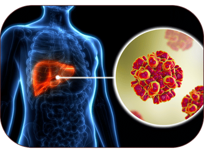 Hepatitis Ayurvedic Treatment in Amritsar