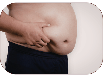 Obesity Ayurvedic Treatment in Amritsar