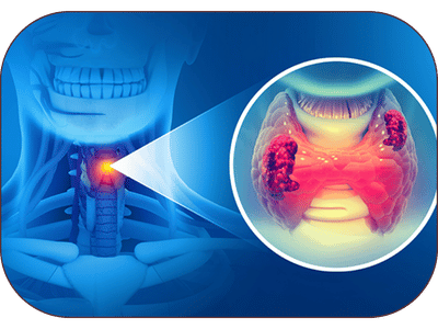 Thyroid Ayurvedic Treatment in Amritsar
